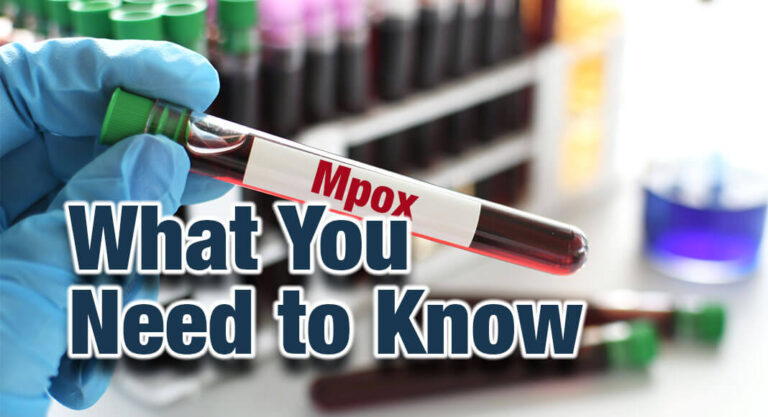 What You Should Know About Mpox Mega Doctor News