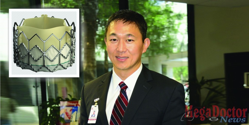 Jason Chang plans to set medical precedent at McAllen Heart Hospital Introducing by yearend heart valve replacement without open-heart surgery