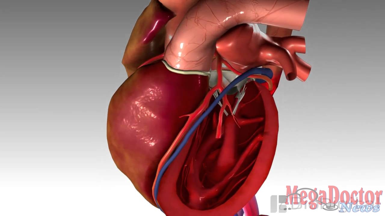 3D Medical Animation - Congestive Heart Failure - Mega Doctor News