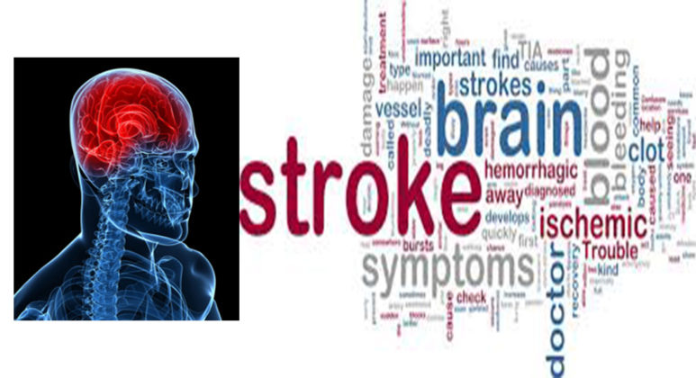 Stroke Awareness Month Continues to Highlight Importance of Stroke ...