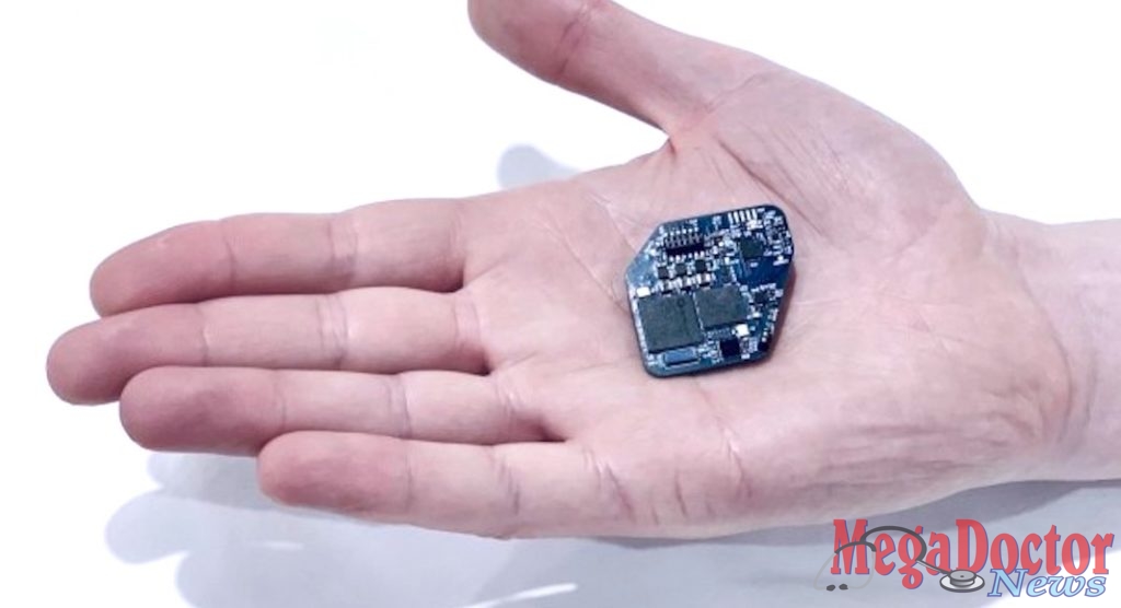 The WAND chip is designed with custom integrated circuits that can record the full signal from both subtle brain waves and strong electrical pulses delivered by the stimulator. Wireless 'pacemaker for the brain' could offer new treatment for neurological disorders.