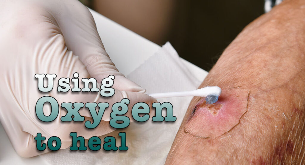 Oxygendelivering hydrogel accelerates diabetic wound healing Mega