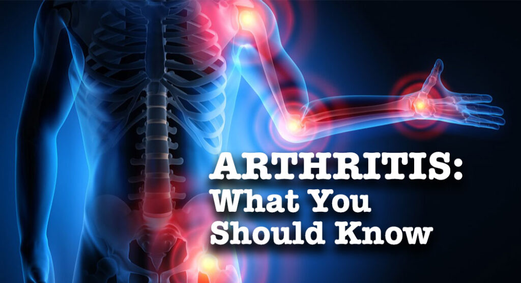 Four Things You Should Know About Arthritis - Mega Doctor News