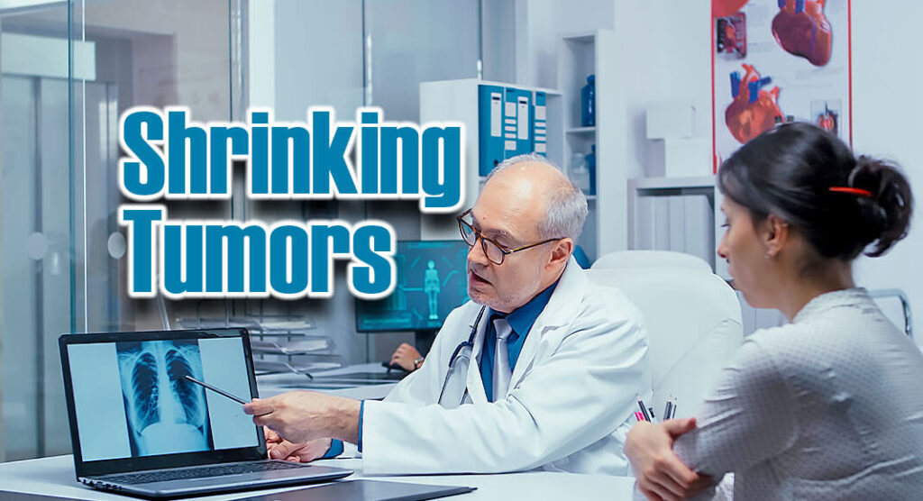 A New Pathway to Shrink Cancerous Tumors Through Body’s Immune Cells