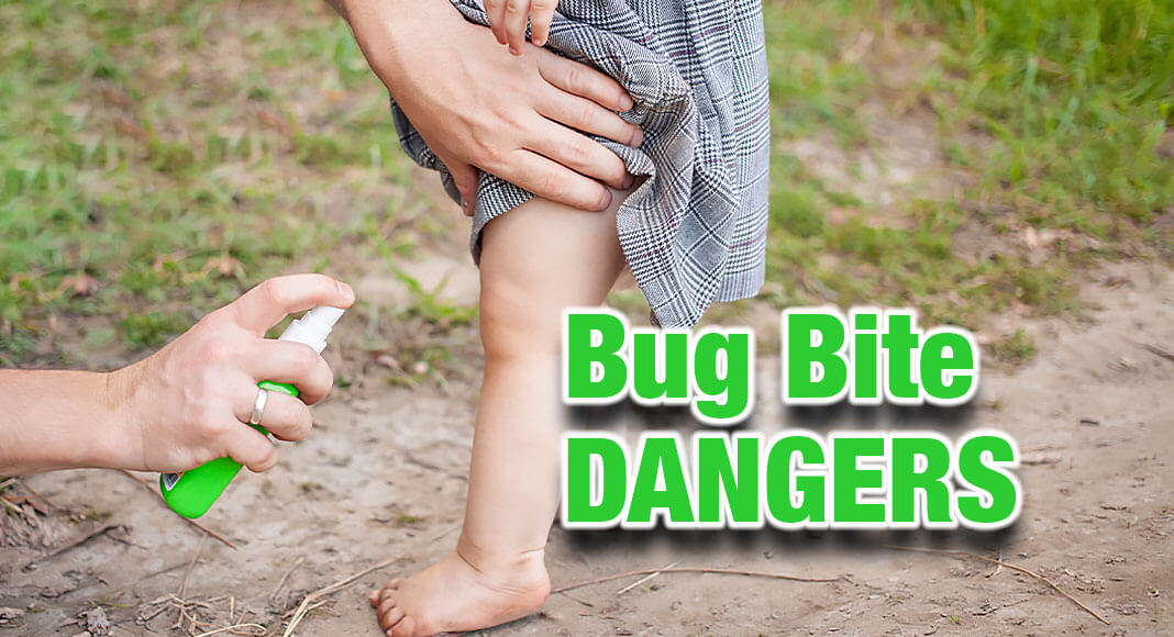 Bugs, including mosquitoes, ticks, fleas, and flies, can spread diseases such as malaria, yellow fever, Zika, dengue, chikungunya, and Lyme. While some cases are mild, these diseases can be severe and have lasting consequences. Image for illustration purposes