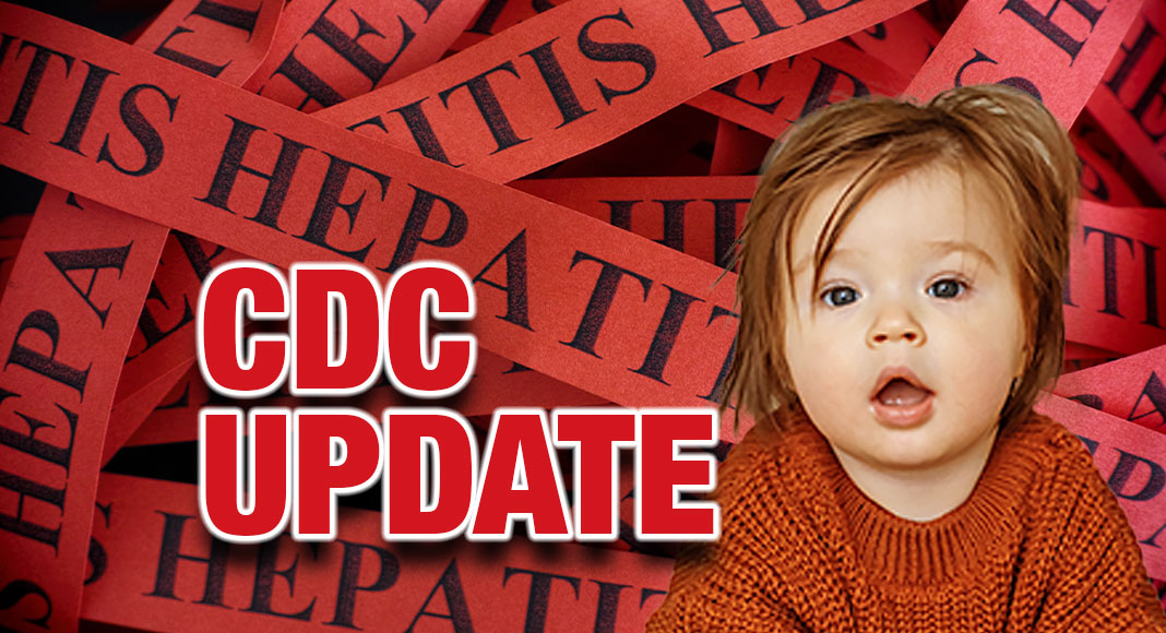 Update on Children with Acute Hepatitis of Unknown Cause - Mega Doctor News