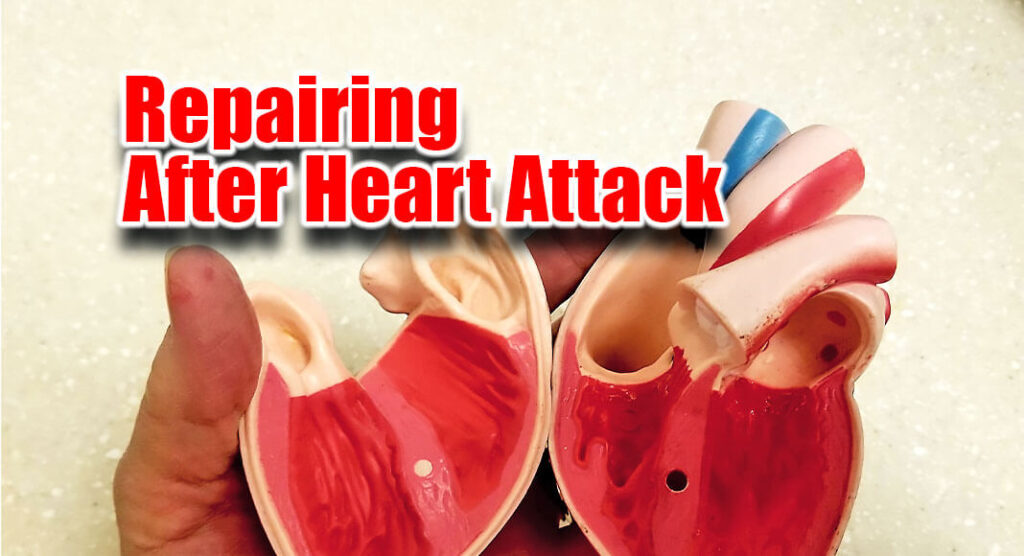 How the Heart Repairs After a Heart Attack Mega Doctor News