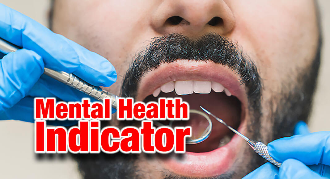 Brushing and flossing your teeth may seem like a mundane task, but did you know there’s actually a link between your oral health and mental health? Image for illustration purposes