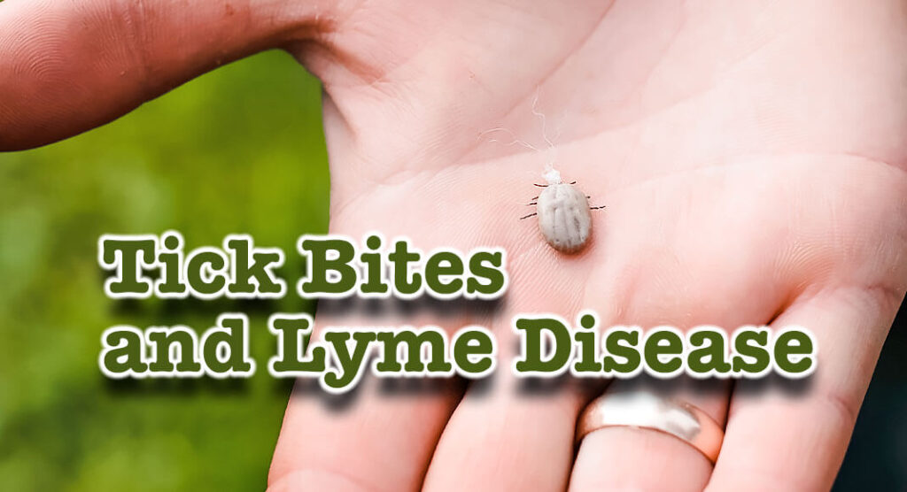 Tick Bites And Lyme Disease Prevention Mega Doctor News