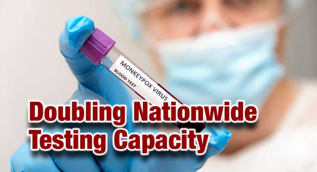 QUEST and Labcorp Monkeypox Testing Mega Doctor News