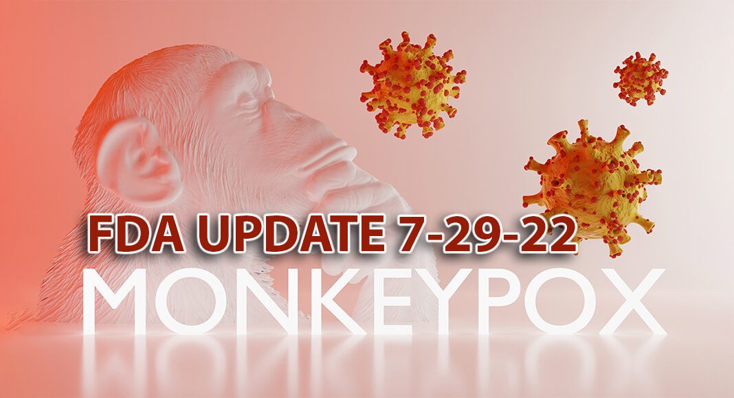 “The FDA has been closely tracking reports of monkeypox transmissions in the United States with our federal public health partners and coordinating preparedness efforts accordingly,” said FDA Commissioner Robert M. Califf, M.D. Image for illustration purposes