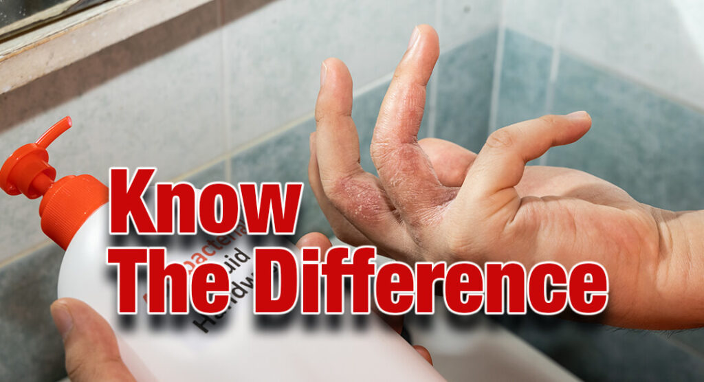Dry Hands or Hand Eczema? Mega Doctor News