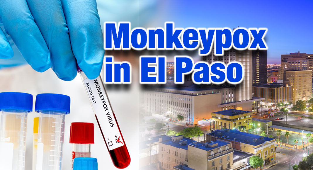The City of El Paso Public Health is reporting a FOURTH Monkeypox case. Image for illustration purposes