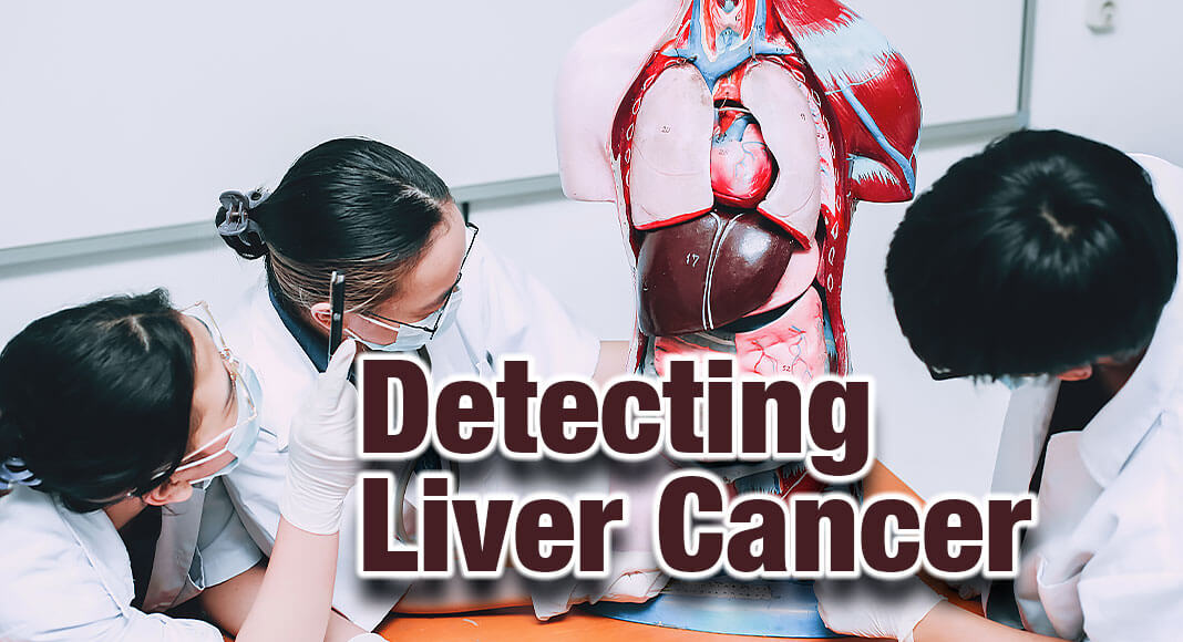 A novel artificial intelligence blood testing technology developed and used by Johns Hopkins Kimmel Cancer Center researchers to successfully detect lung cancer in a 2021 study has now detected more than 80% of liver cancers in a new study of 724 people. Image for illustration purposes