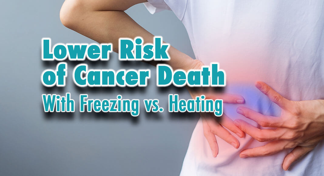 For patients with early-stage renal cell carcinomas (RCCs) that measure between 3 and 4 centimeters, a procedure that destroys the cancer by freezing – called cryoablation – yields a lower-risk of cancer-related death compared to heat-based thermal ablation. Image for illustration purposes