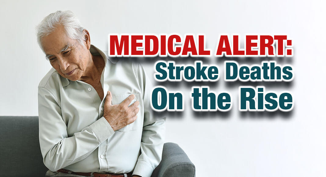 After nearly four decades of declining stroke-related mortality, the risk appears to be increasing in the United States.  Image for illustration purposes