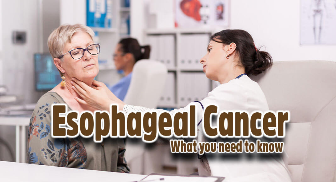 Esophageal cancer is cancer that occurs in the esophagus — a long, hollow tube that runs from your throat to your stomach.Image for illustration purposes