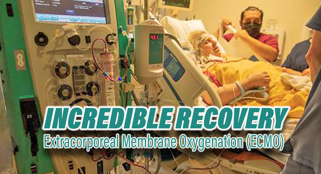DHR Health is proud to announce the first successful use of Extracorporeal Membrane Oxygenation (ECMO), also known as extracorporeal life support, to save the life of a 57 year old Edinburg, Texas woman. Courtesy Image 