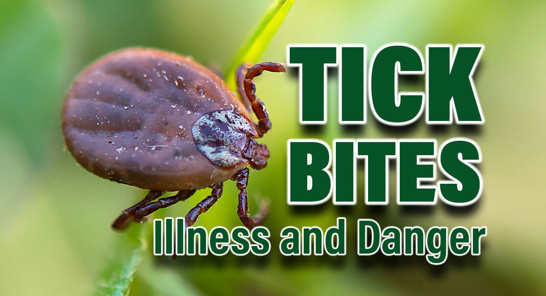 Most of the country, including the Northeast, Midwest, South, and portions of the West are home to one or more tick species known to spread the germs that cause ehrlichiosis and anaplasmosis. Image for illustration purposes