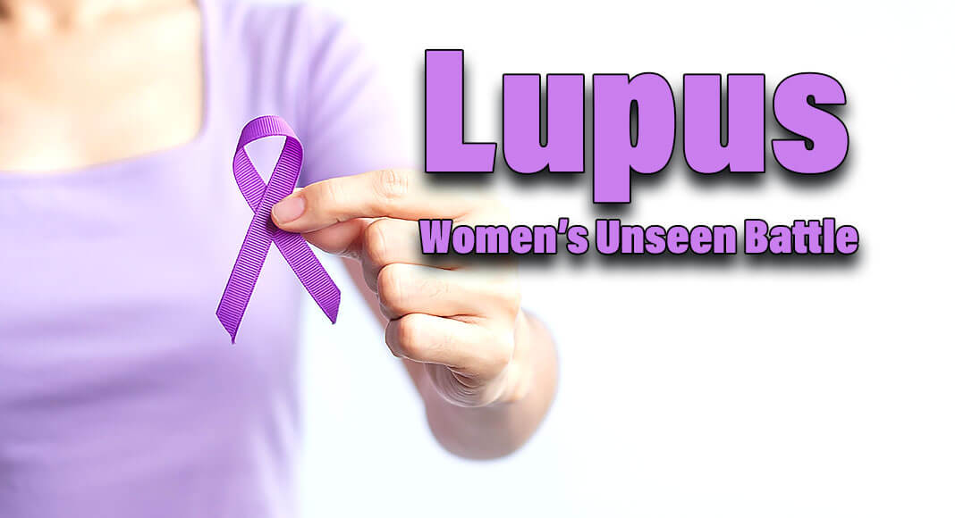 Some people call lupus an “invisible illness” because it is often not recognizable to others. Image for illustration purposes