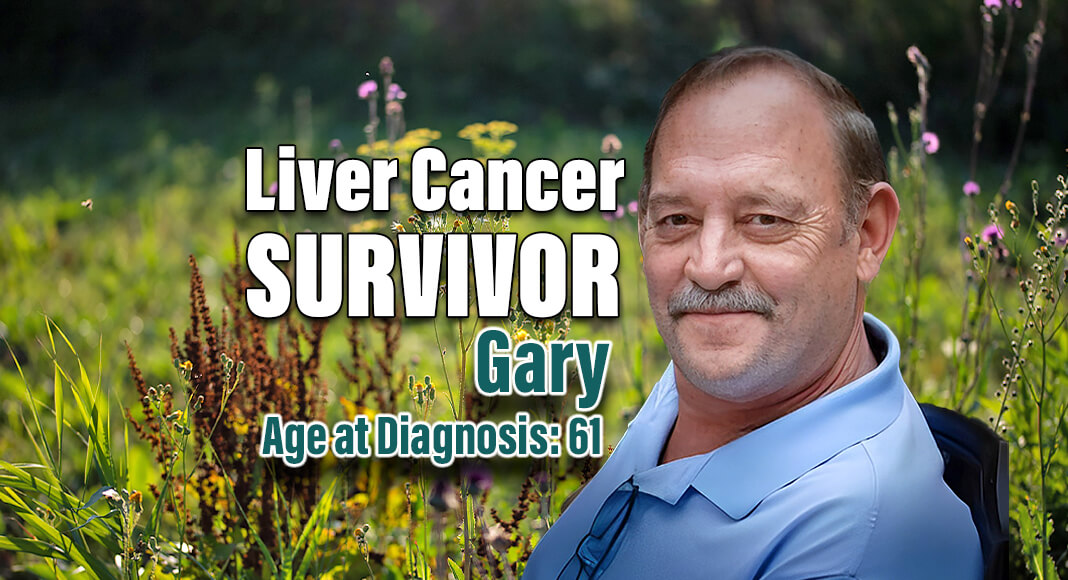 There are no recommended regular screening tests for liver cancer. “Most people don’t realize they have it until it’s much later on,” says Gary, who lives in Atlanta, Georgia. image Courtesy of CDC for illustration purposes