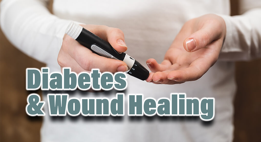 A person who manages their diabetes well can improve the rate at which wounds heal and reduce the likelihood of a severe infection. Image for illustration purposes