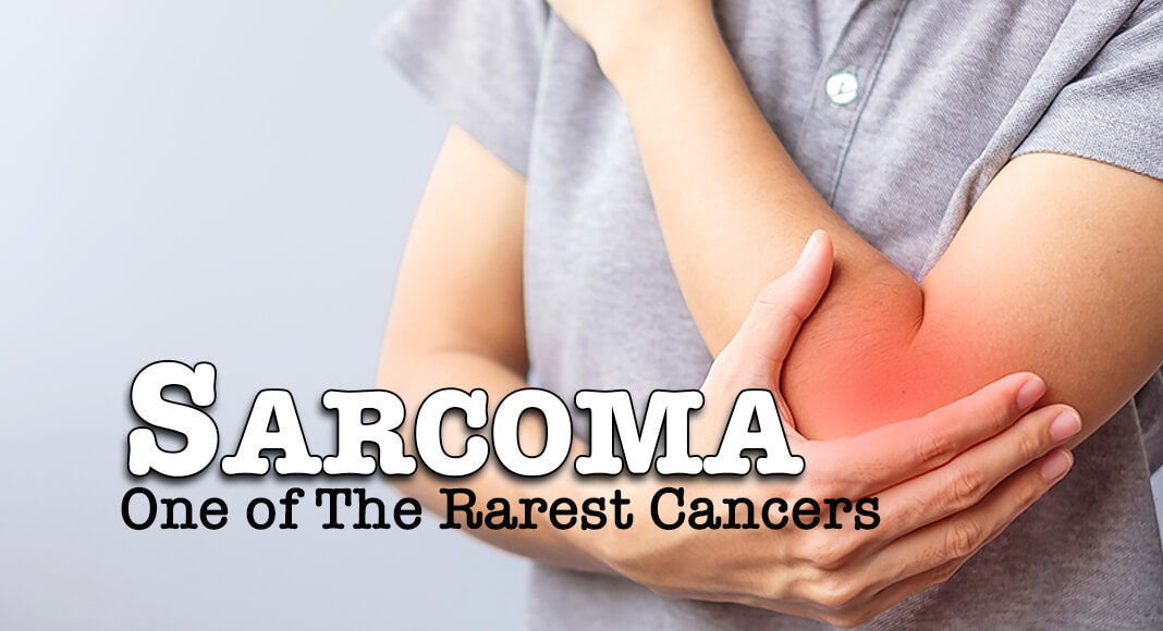  From the top of your head to your toes, sarcoma can grow in bones, muscles, tendons, cartilage, and any connective tissue, which makes it a difficult disease to detect. Image for illustration purposes