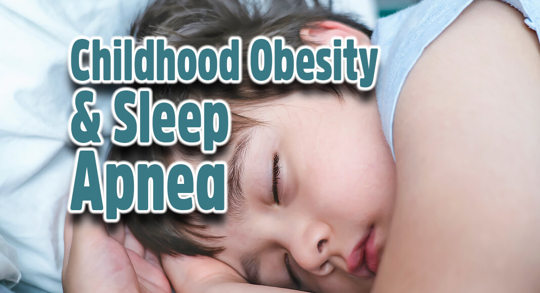 Obesity and older age are significant predictors of the severity of obstructive sleep apnea (OSA) in children, researchers at UT Southwestern Medical Center and Children’s Health found. Image for illustration purposes