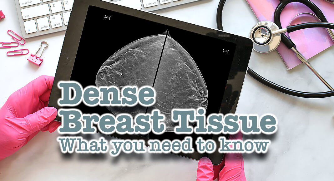 “So essentially dense breast tissue refers to the amount of milk ducts and connective tissue in the breast,” said Laura Dean, MD, diagnostic radiologist for Cleveland Clinic. “And the reason it’s important with respect to screening for breast cancer is that dense breast tissue, or the connective tissue and the milk ducts, show up on the mammogram as white.” Image for illustration purposes