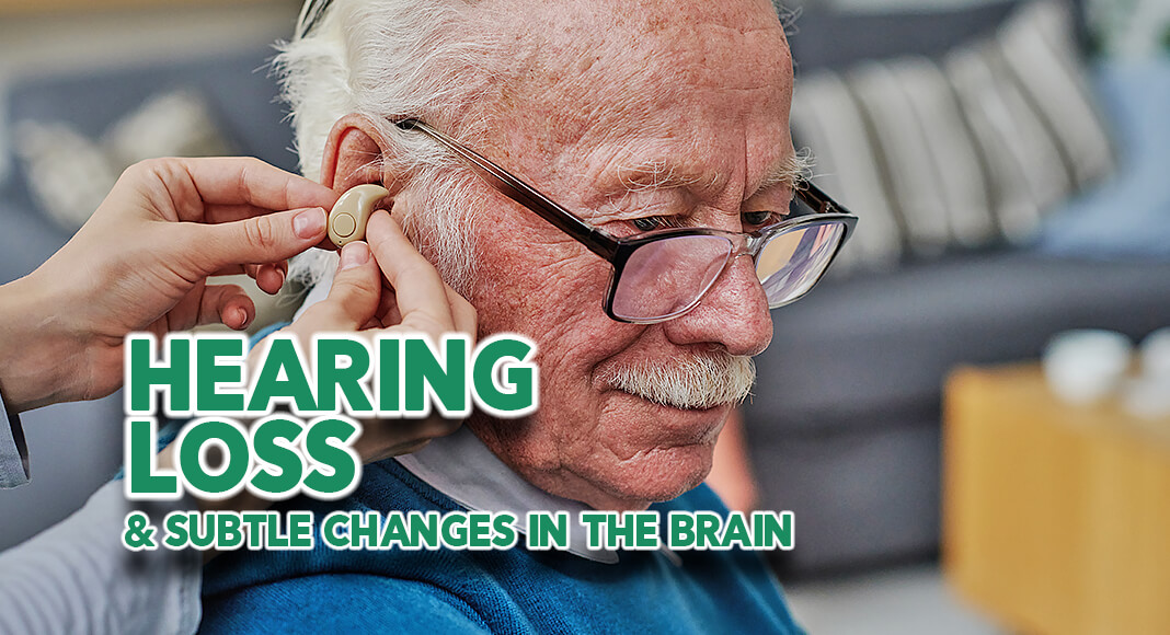 Hearing loss affects more than 60 percent of adults aged 70 and older in the United States and is known to be related to an increased risk of dementia. The reason for this association is not fully understood. Image for illustration purposes