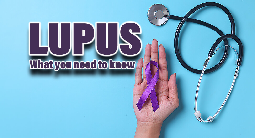 Lupus is a disease that can affect people of all ages, races, and ethnicities. The signs and symptoms mimic those of other diseases, making it hard to diagnose. Image for illustration purposes