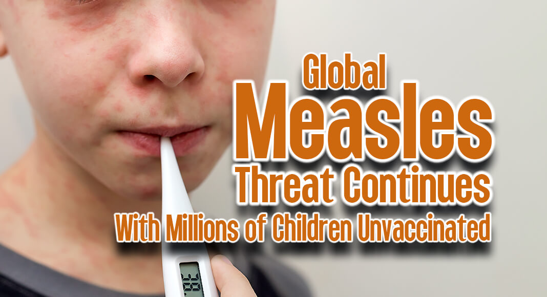 Measles continues to pose a relentlessly increasing threat to children. Image for illustration purposes