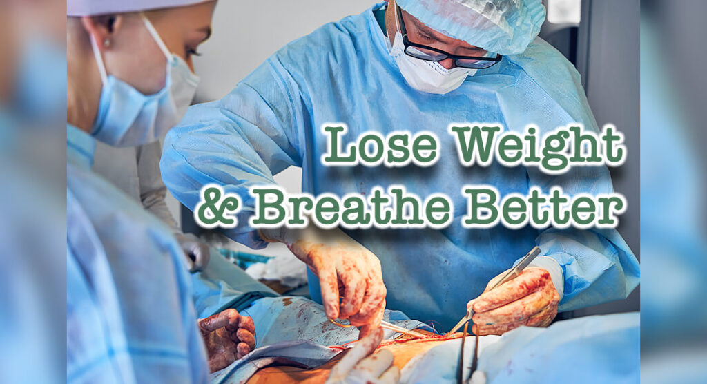 Bariatric Surgery Triggers Substantial Weight Loss Improves Lung Function Mega Doctor News
