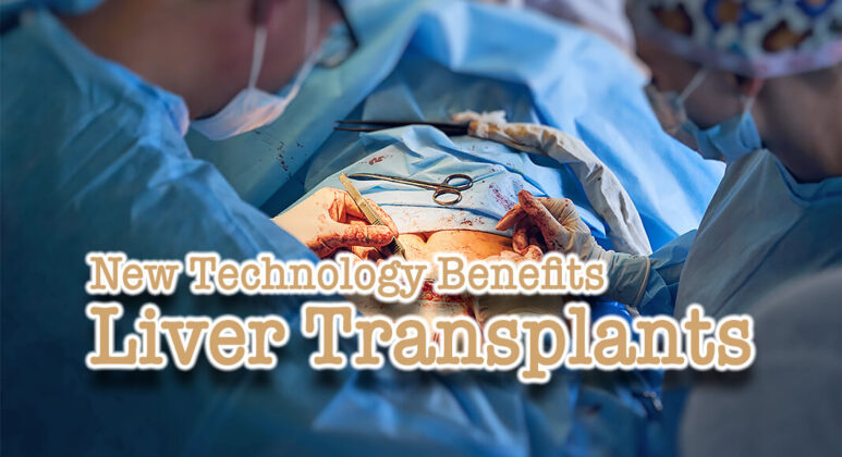 New Technology Benefits Liver Transplants - Mega Doctor News