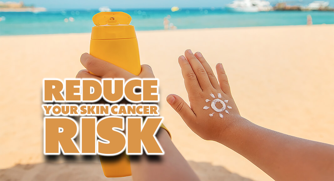 Its Never Too Early Or Too Late To Reduce Your Skin Cancer Risk Mega