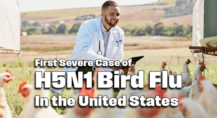 First Severe Case of H5N1 Bird Flu in the United States Confirmed ...