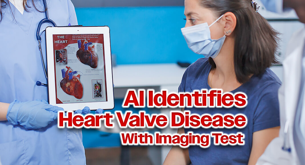 An artificial intelligence (AI) program trained to review images from a common medical test can detect early signs of tricuspid heart valve disease and may help doctors diagnose and treat patients sooner, according to research from the Smidt Heart Institute at Cedars-Sinai. Image for illustration purposes