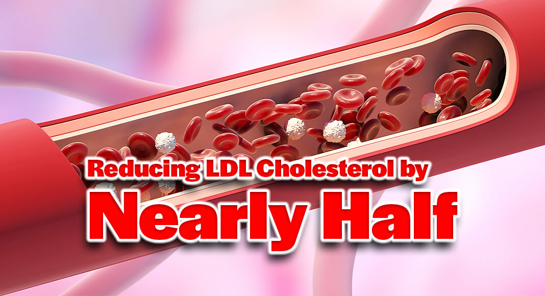 LDL, or low-density lipoprotein, carries cholesterol throughout the body and can accumulate in artery walls, leading to plaque buildup. Image for illustration purposes