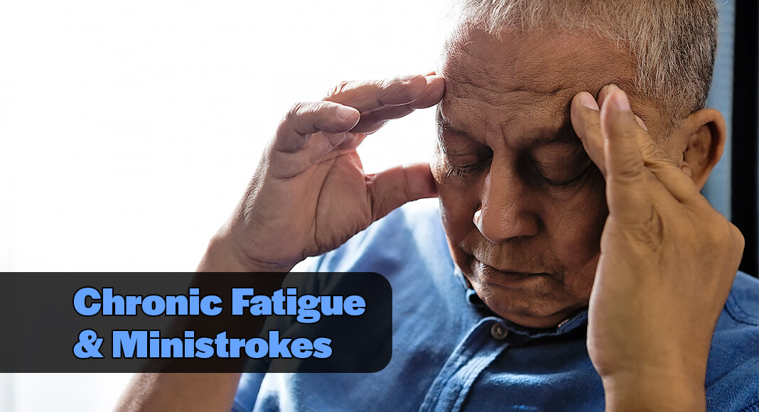 Transient ischemic attacks may result in 1 year of chronic fatigue, a new study finds. Image for illustration purposes