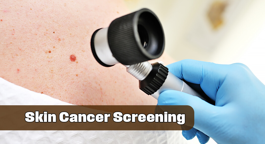 Melanoma is an aggressive form of skin cancer. In 2025, an estimated 104,960 cases of invasive melanoma will be diagnosed in the U.S., and an estimated 8,430 people will die of melanoma, according to the American Cancer Society. When detected early, however, the five-year survival rate for melanoma is 99%. Image for illustration purposes
