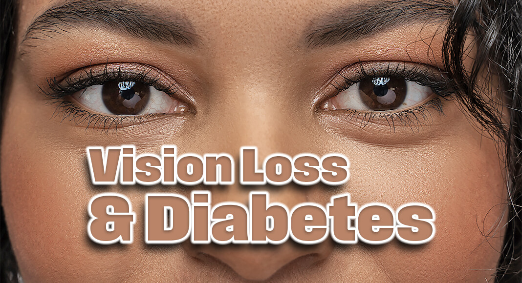 Diabetes is a major health crisis in the U.S. that not only bears a heavy economic burden but increases the risk of severe health complications, including blindness. From May 4 - 8 in Salt Lake City, Utah, scientists will unveil new findings on various diabetes-related eye complications at the 2025 Annual Meeting of the Association for Research in Vision and Ophthalmology (ARVO). Image for illustration purposes