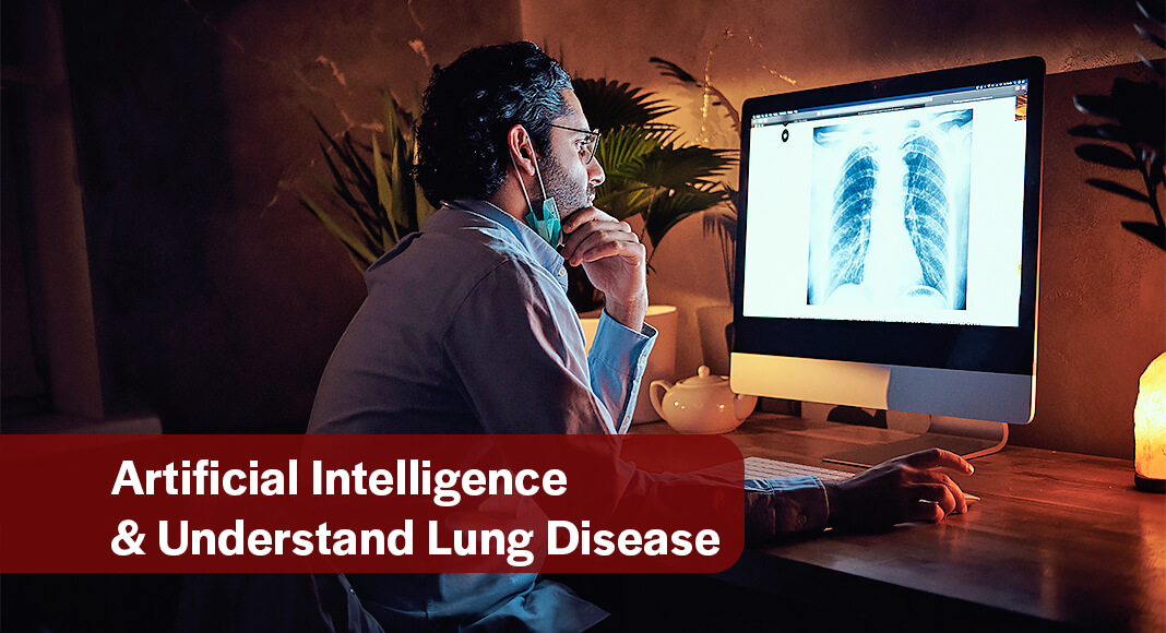 In a new study published June 20 in Nature Biomedical Engineering, researchers at Yale School of Medicine and collaborators took a significant step toward understanding IPF—and numerous other complex diseases—with an algorithm that interprets disease data and proposes treatments. Image for illustration purposes