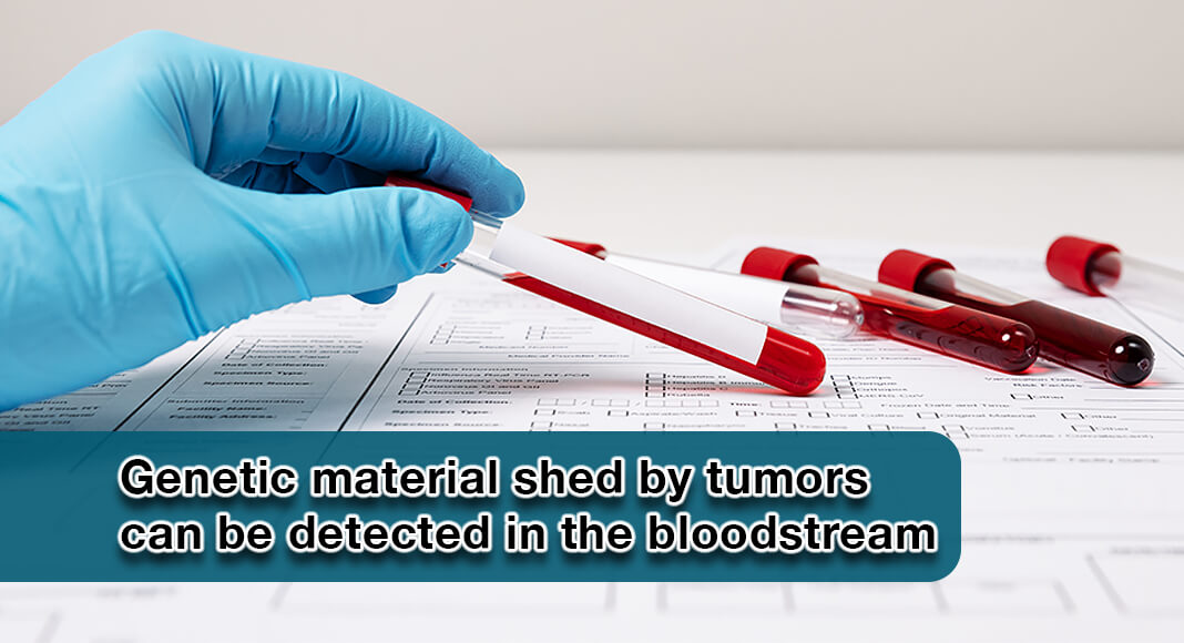 Genetic material shed by tumors can be detected in the bloodstream three years prior to cancer diagnosis, according to a study led by investigators at the Ludwig Center at Johns Hopkins, Johns Hopkins Kimmel Cancer Center, the Johns Hopkins University School of Medicine and the Johns Hopkins Bloomberg School of Public Health. Image for illustration purposes