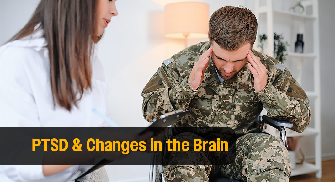 A new Nature study zooms in to the single-cell level to see how this cellular communication may be going wrong in brains affected by post-traumatic stress disorder (PTSD). Image for illustration purposes