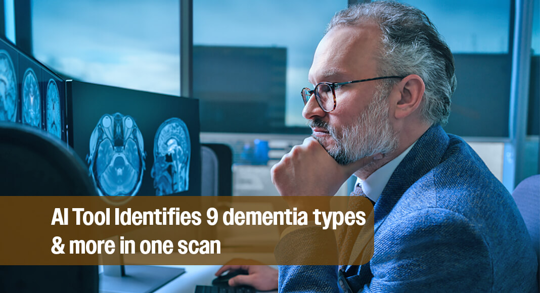 Dr. David Jones reviews brain scans on a computer at Mayo Clinic. Image: Mayo Clinic via Newswise