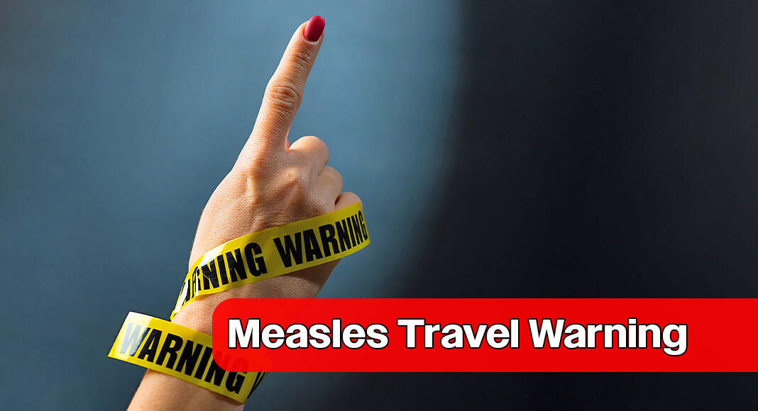Rright now, there are widespread cases of measles in most parts of the world including Europe, Asia, Africa, the Middle East,” said Camille Sabella, MD, pediatric infectious disease specialist at Cleveland Clinic Children’s. Image for illustration purposes