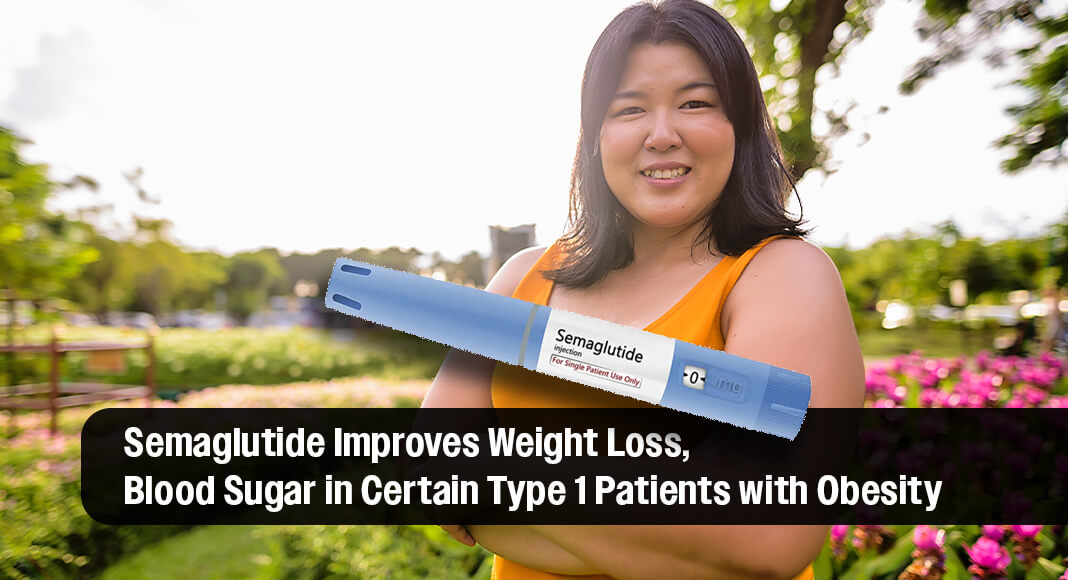 A clinical trial led by an Indiana University School of Medicine researcher found that weekly doses of semaglutide — a medication typically prescribed to Type 2 diabetes patients — improved blood sugar levels and weight loss for adult Type 1 diabetes patients who use automated insulin delivery systems and have a body mass index of 30 or higher. Image: Public Domain. Bgd for Illustration purposes