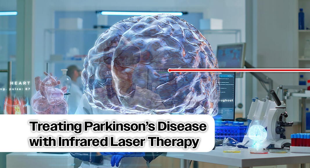 The goal is to improve symptoms by targeting brain regions affected by Parkinson’s, such as the frontal cortex, which supports executive function and memory and helps control motor behavior. Image for illustration purposes