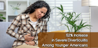 Alarming Rise in Severe Diverticulitis Among Younger Americans