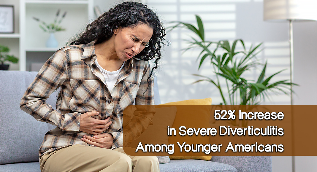 A comprehensive analysis of over 5.2 million hospitalizations reveals a troubling surge in severe diverticulitis cases among Americans younger than 50. Image for illustration purposes